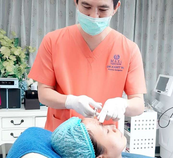 ฟิลเลอร์หน้าผาก ปรับโหงวเฮ้ง